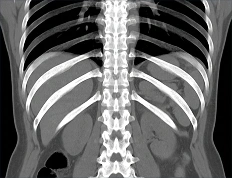 Clinical rib imaging